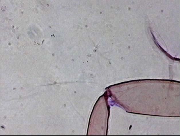 Tür: Phenacoccus pumilus Kiritshenko, 1935 (Şekil 4.