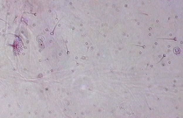 28. a) Pseudococcus longispinus'ta cerari yanında mantar şekilli kanal ve b) P. viburni de anal lob ve anal cerari. Tür: Pseudococcus viburni (Signoret, 1975) (Şekil 4.