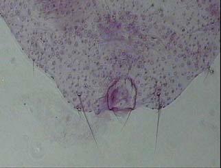 Mirococcus inermis in a) canlı dişisi, b) preparat yapılmış dişisi ve c) anal halkası. Ankara ilindeki dağılımı ve konukçuları: Çizelge 4.21 