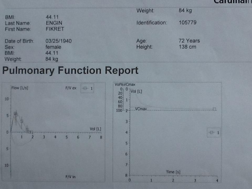 PRED ACTUAL % PRED FVC 1,35 1,85 137