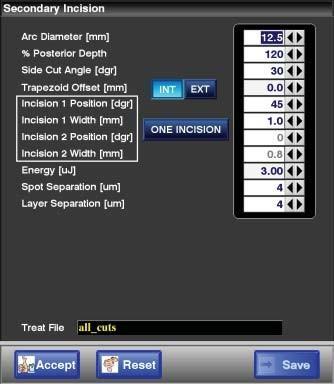 Şekil 6-8: Secondary Incision Pattern (Sekonder İnsizyon Modeli) parametre ekranı Tüm parametreler girildikten sonra, ekranın alt kısmında görüntülenen Accept ve Save tuşlarına basın.