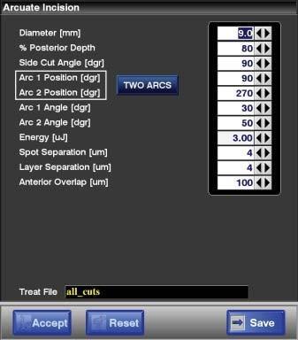 Şekil 6-9: Arcuate Incision Pattern (Arkuat İnsizyon Modeli) parametre ekranı 6.2.