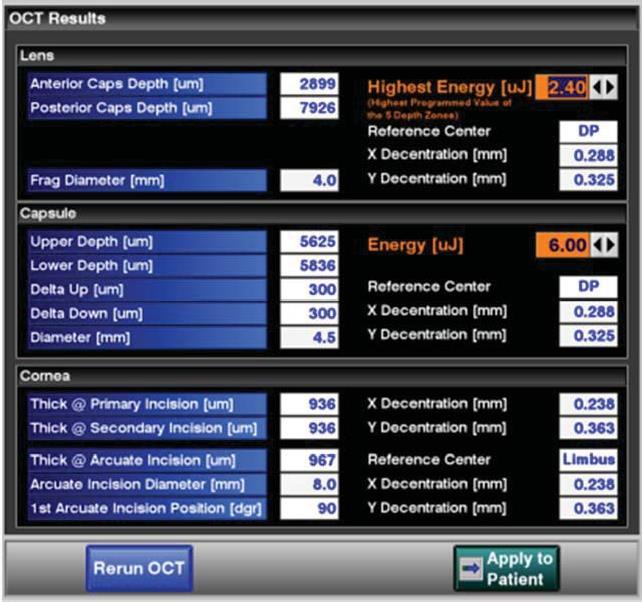 Şekil 6-26: OCT modeli ayar sonuçları. Sonuçlar kabul edilebilirse Apply to Patient (Hastaya Uygula) tuşuna basın.