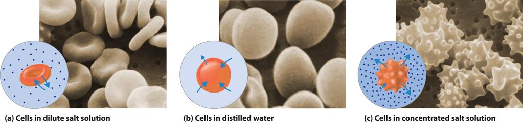 Seyreltik tuzlu çözeltisinde hücreler Distile su içinde