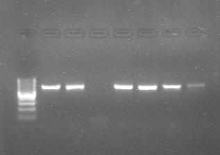 PCR product