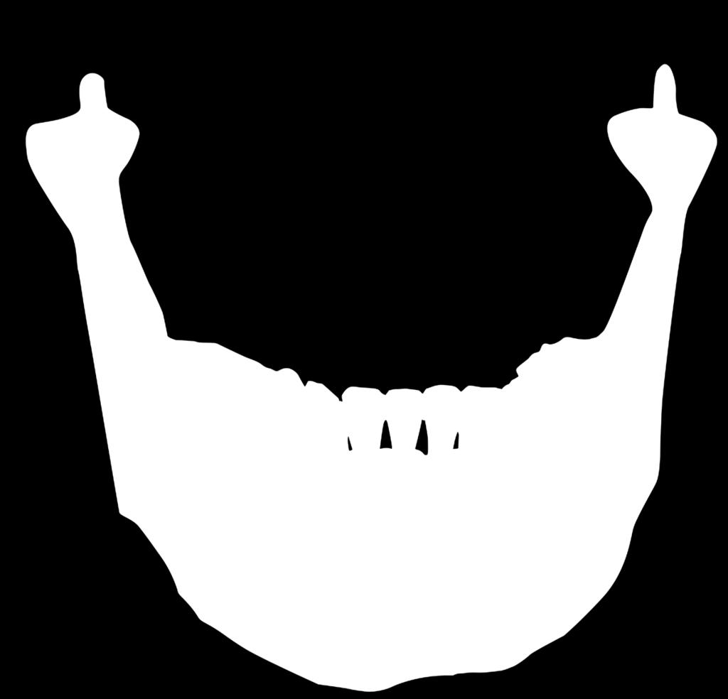 premolar diş hizasında bulunur. Linea mylohyoidea, iç yüzde bulunur ve m. mylohyoideus tutunur. Caput mandibula, art. temporamandibularis e katılır. Fovea pterygoidea, m.