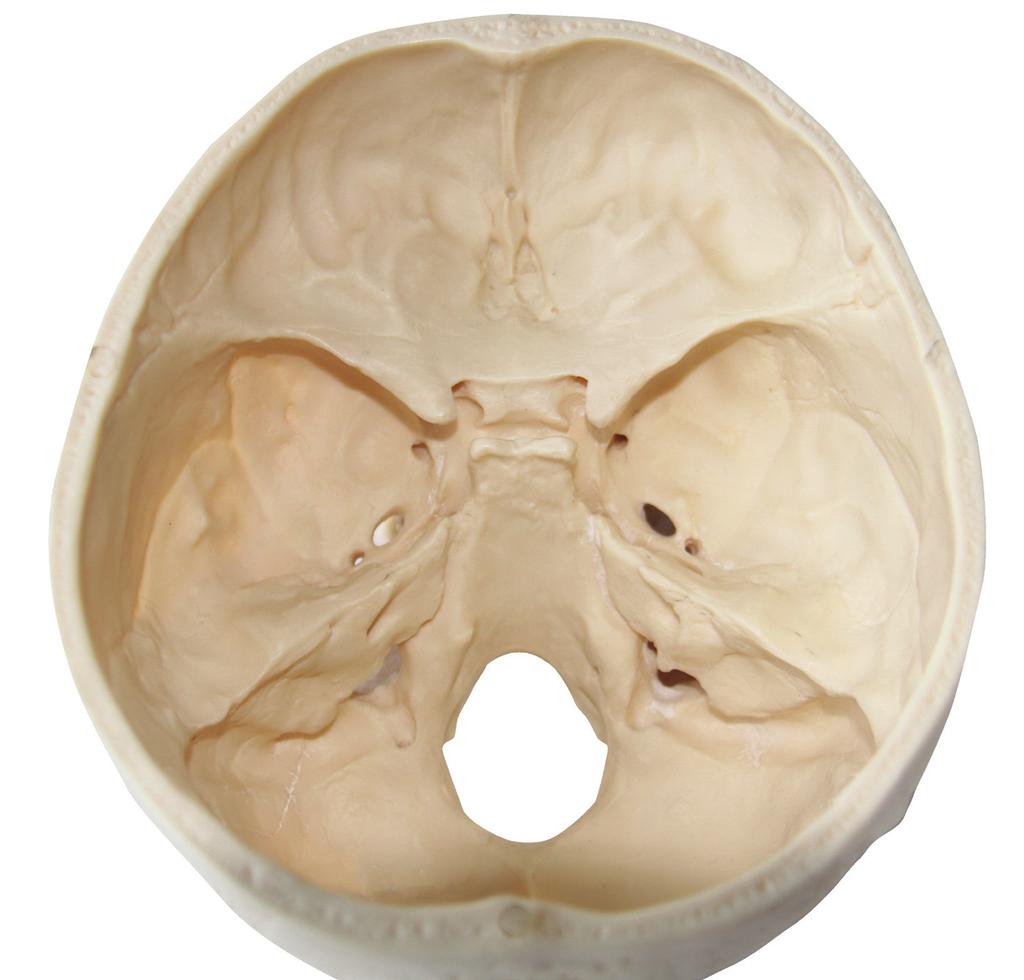 sulcus caroticus foramen ovale foramen spinosum apertura interna canalis caroticus porus acusticus internus