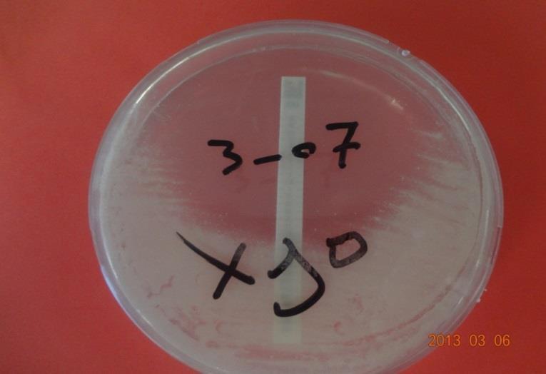 41 inoküle edilmiģ 7H11 Middlebrook besiyerinin üzerine uygulandıktan hemen sonra önceden emdirilmiģ antibiytic maddeyi besiyerin üzerine bırakıyor.
