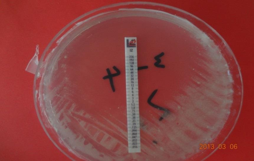 8 tanesi de kontaminasyondan dolayı değerlendirilmemiģtir. ġekil 4.3. M. tuberculosis ve M.