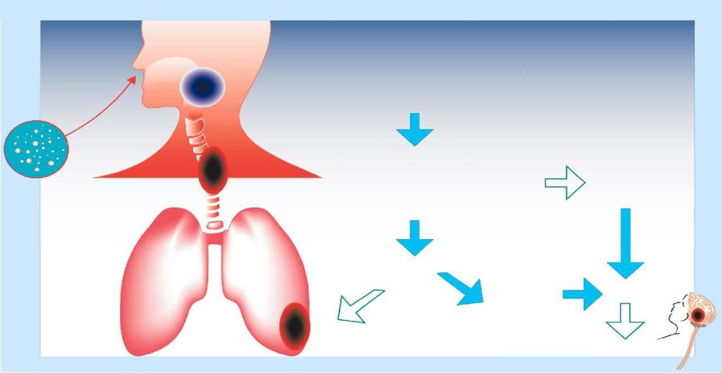 İnhalasyon Bakterilerin nazofarinksteki epitel hücrelerine yapışması (PT, FHA, PRN, Fim Yardımıyla) Respiratuar Damlacıklar Bakterilerin çoğalması, silialı bronşiyal ve