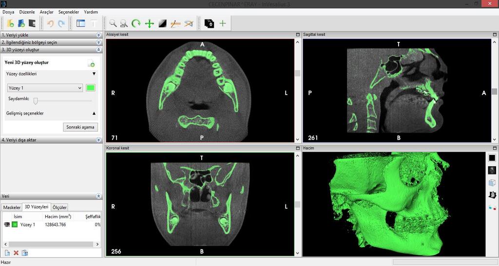 GÖRÜNTÜ İŞLEME PROGRAMLARI INVESALIUS 3.