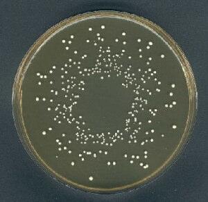 2.1.1.4. Lactobacillus casei Streptobacterium grubu içinde yer alır. 1.5 µm den daha küçük çaplı ve uçları uzun veya kısa çubuk şeklinde, zincir oluşturabilen, flagellasız ve hareketsizdir.