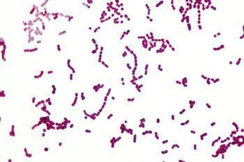 14 2.1.2.2. Lactococcus lactis ssp. lactis (Str. lactis) 13 te Lister, Bacterium lactis olarak adlandırmıştır. Oval hücreleri 0.5-1.0 µ ve düzgündür.