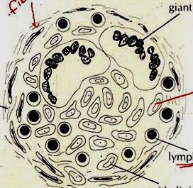 M. tuberculosis Makrofaj Class II MHC T Hücre reseptörü Basile ait antijenik peptit CD4 T Hücresi SİTOKİNLER Gecikmiş tip aşırı