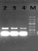 Şekil 16 da görüldüğü üzere, farklı QD konsantrasyonlarının 30 döngü ile gerçekleştirilen L g DNA sının kalıp olarak kullanıldığı PCR üzerine etkisi incelendiğinde 6,25 nm QD konsantrasyonun PCR