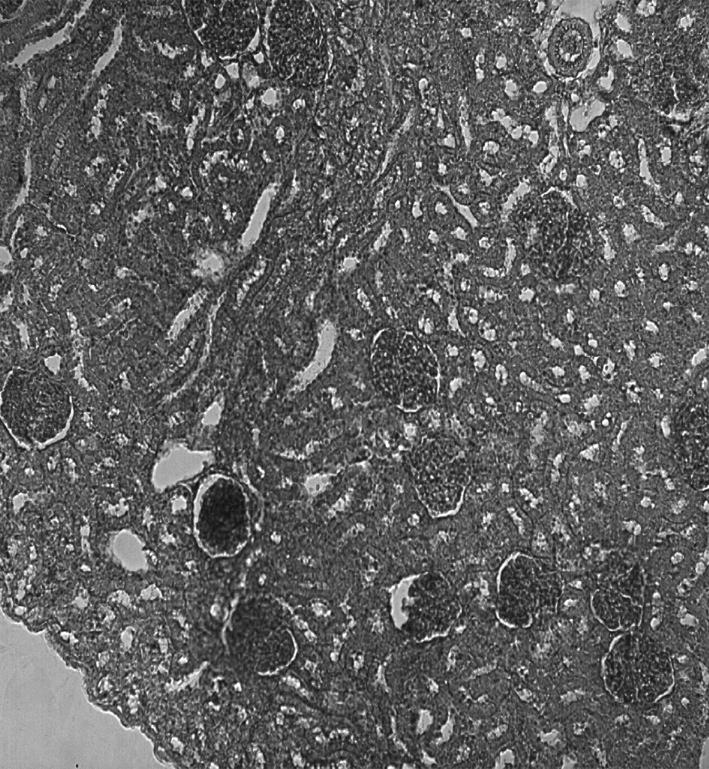 Yüksek doz endosulfan grubuna (Grup II) ait böbrek dokusunun morfolojik görünümü.