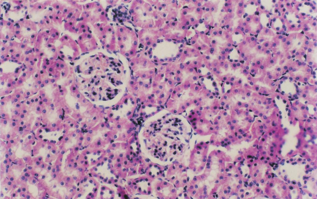 26 Özer, Myokardiyal iskemi reperfüzyon ve böbrek hasarý Þekil 1: Kontrol grubu; Glumerulus ve tubuluslar normal. (H-E X 66).
