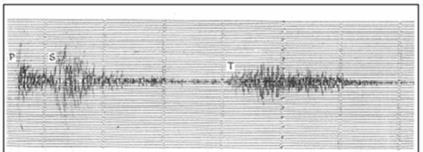 Rg Bir patlatmadan elde edilen Rg dalgası (Uzaklık 39 km). Üstte ham, altta kesme frekansı 4.0 Hz olan alçak geçişli filtrelenmiş iz görülmektedir (Kafka and Ebel, 1988 den).