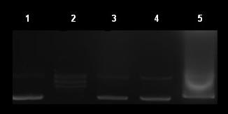 Volume X Number X p: xx-xx Şekil 4. Bileşik 2, 3, 4 ve 5 in HeLa, HT29 ve C6 hücre hatlarında DNA bantlaşma deneyi (Apoptoz). Test edilen Hücrelerin DNA sı izole edilerek 1.