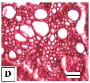 50µm) A: O.