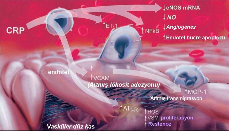 fibröz kapsülde incelmeye yol açacaktır. Fibröz kapsülde incelme, kollajen desteğini azaltan MMPs ın, interstisyel kollajenazlar ve jelatinazların aşırı üretimini artırır 110.