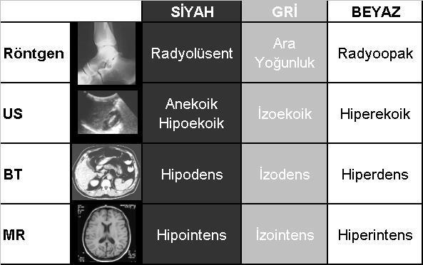 Sayfa No 4 / 49 BİLGİSAYARLI TOMOGRAFİ ÇEKİMLERİ BEYİN BT AKSİYEL Kesitler supra orbito meatal hatta paralel olmalıdır.