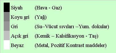 Rutinde kontrastsız çekilmekle birlikte herhangi bir kitle yada lezyondan şüpheleniliyorsa intravenöz kontrast verilerekte çekilebilir.