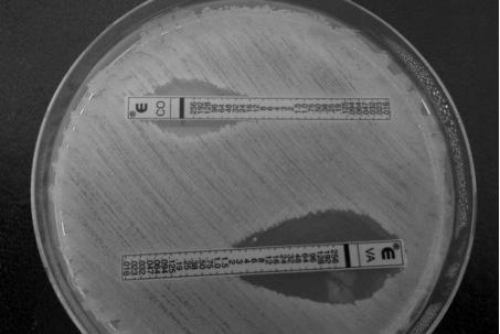 Kolistin maruziyeti sonrası çoklu ilaç direncine sahip Acinetobacter baumannii kan izolatı. Şekil 5.