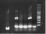 50 1 2 3 4 5 6 7 8 Belirteç 300bp 200bp 100bp Şekil 4.1. P. gingivalis agaroz jel görüntüsü Hat1 : 1 numaralı örnek DNA sı P. gingivalis negatif Hat2 : 2 numaralı örnek DNA sı P.