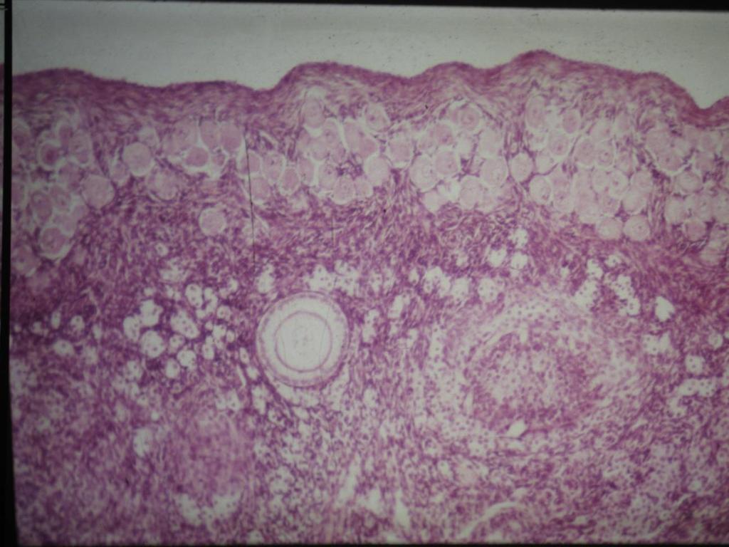 Ovogenezis Dişi eşey hücresinin gelişip olgunlaşmasıdır. Spermatogeneziste olduğu gibi çoğalma, büyüme ve olgunlaşma evreleri vardır. Çoğalma evresi prenatal dönemde gözlenir.