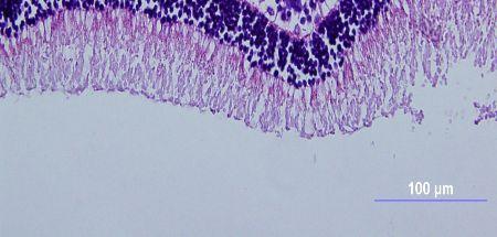 bevacizumab ile birlikte intraperitoneal L-karnitin uygulanan tavaşanların çalışma ve kontrol gözlerinde, morfolojik açıdan farklılık tespit edilmedi.