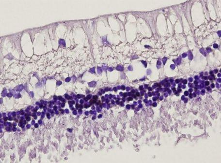 24 ml intravitreal bevacizumab uygulaması ile birlikte intraperitoneal L-karnitin uygulanan tavşanların