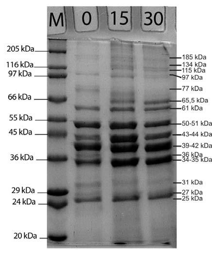 34-35 arasında geniş 4 bant, 36, 31, 27 ve 25 kda olmak üzere 12 ana protein bandı tespit edilmiştir. Sadece 77 kda da belirlenen bant 15.