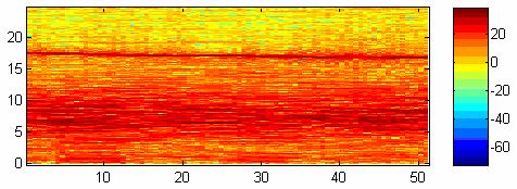 Frekans Zaman s Şekil 32: Sağ (y) bacak ortostatik pozisyon spektrogramı.