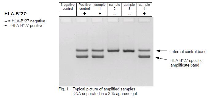 + 5 μl PCR-H2O + 5 μl kontrol template (ca. 20 ng/μl) + 5 μl DNA (ca. 20 ng/μl) PCR thermocyclerde aşağıda listelenen sıcaklık rejimi kullanılarak yapılmaktadır: İlk denatürasyon: 15 dak.