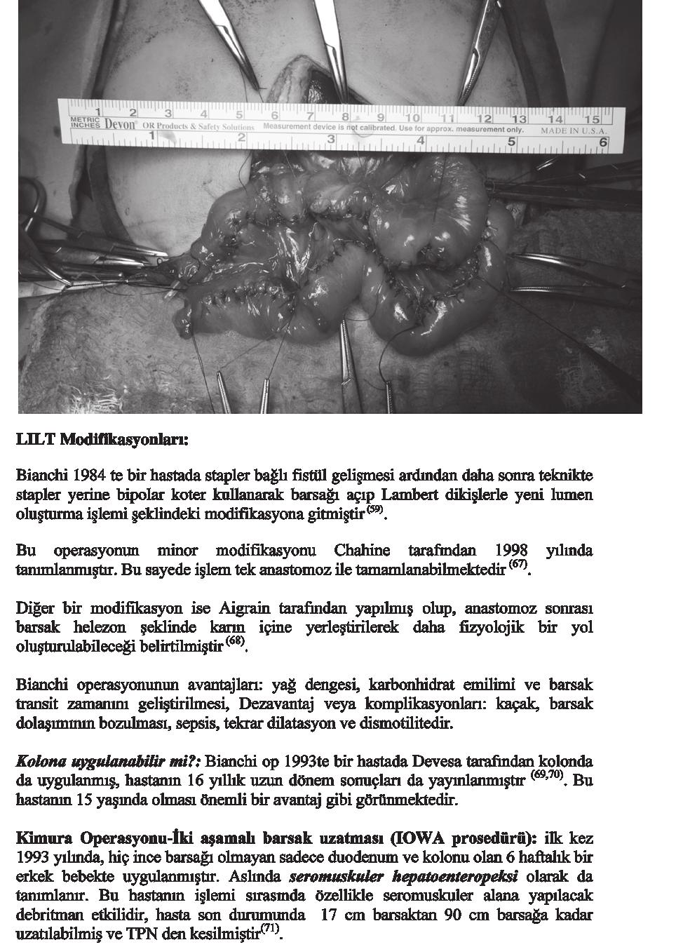 Bu hastanın işlemi sırasında özellikle seromuskuler alana yapılacak debritman etkilidir, hasta son durumunda 17 cm bağırsaktan 90 cm barsağa kadar uzatılabilmiş ve TPN den kesilmiştir (71). Resim 4.