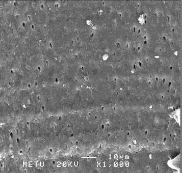 35 Resim 4.5.NSK Varios 750 grubunda kökün apikal üçlüsüne ait SEM görüntüsü Debris