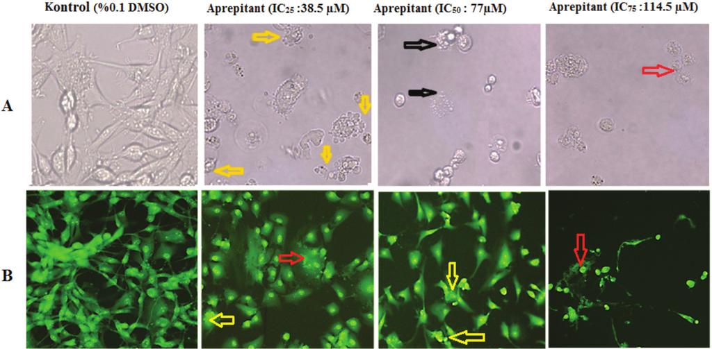 162 Aprepitantın İnsan Glioblastoma U87MG Hücreleri üzerinde Antiproliferatif ve Apoptotik Etkileri Marmara Pharm J 21: 156-164, 2017 Akridin Turuncusu Floresan Boya ile Apoptotik Hücrelerin