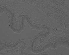 den numaralı rattan alınan özofagusun DiI işaretli MKH in epitelde daha fazla olmak üzere mikroskopik görüntüsü. Resim 3.