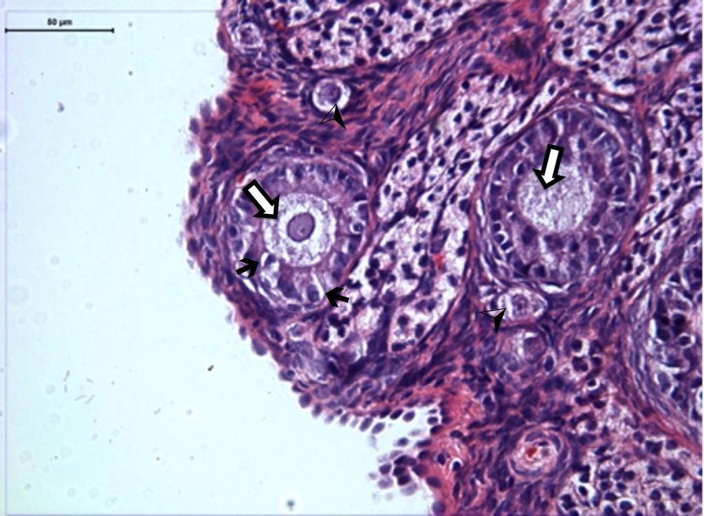 40 Grup II de primordial ve erken multilaminer folliküllerde yer alan oositlerin sitoplazmasında vakuolizasyonlar ve özellikle primer folliküllerdeki granüloza hücreleri arasında junctional
