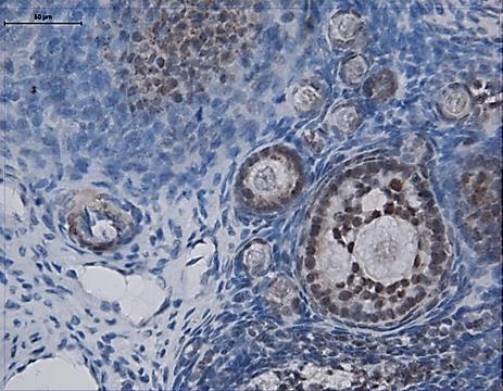 47 Grup II de cyclophosphamide grubunda olduğu gibi primordial follikülden itibaren gelişen folliküldeki granüloza hücreleri arasında connexin-43 tutulumu gözlenmezken (Resim4.