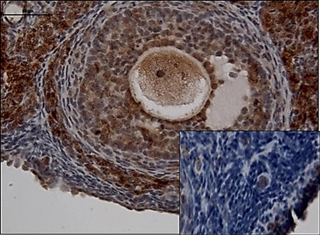 57 Grup III de primordial folliküllerde yer alan oositlerde ve granüloza hücrelerinde orta derecede BMP-15 tutulumu gözlenirken (Resim 4.