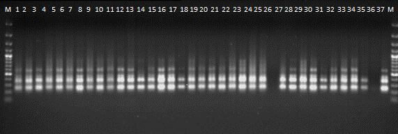 20 Şekil 3.2.2.7.2. F5 Primerinin Bulk-1 için DNA jel görüntüsü Şekil 3.2.2.7.3. F5 Primerinin Bulk-2 için DNA jel görüntüsü 3.