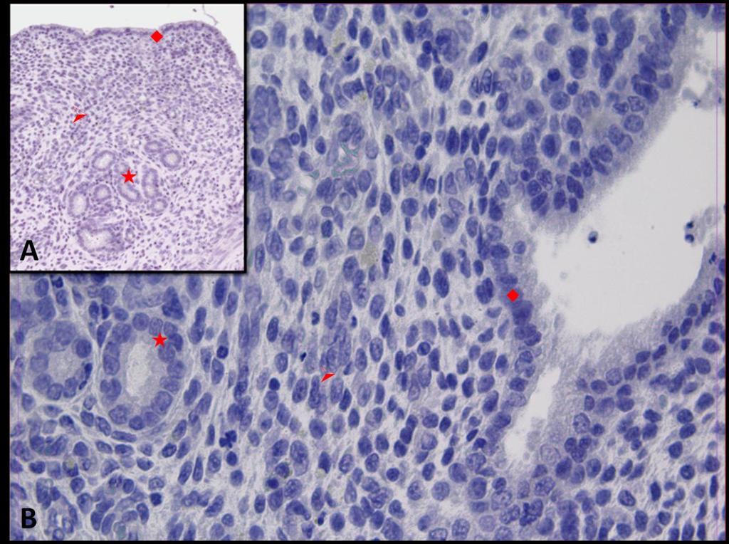 Fotoğraf 2A, B: Hipertermi uygulamasından bir saat önce NaCl+Katalaz uygulanan ve 30 dakika sonra örneklerin alındığı gruba ait uterus dokusunda Kaspaz