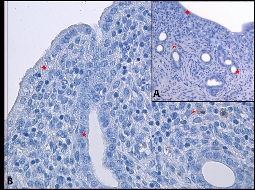 Fotoğraf 8A, B: Hipertermi uygulamasından bir saat önce NaCl+Katalaz uygulanan ve 72 saat sonra örneklerin alındığı gruba ait uterus dokusunda Kaspaz 8