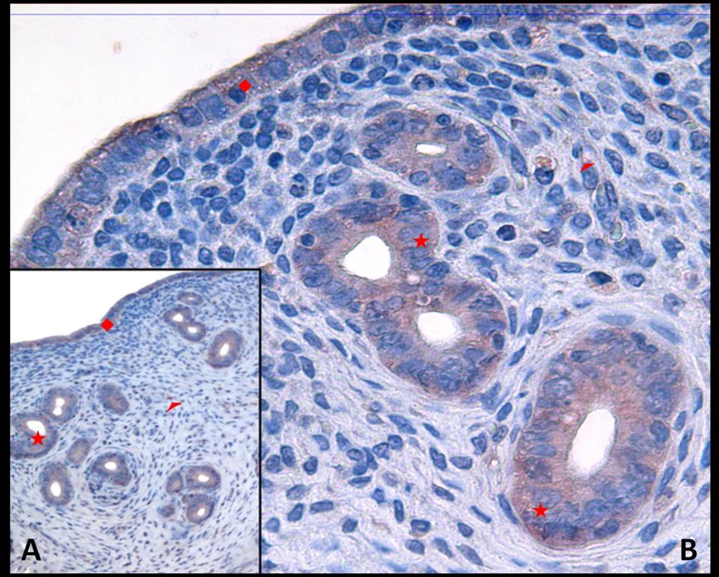 Fotoğraf 12A, B: Hipertermi uygulamasından bir saat önce NaCl+ Katalaz+ SOD uygulaması yapılan ve hipertermi sonrası 30.