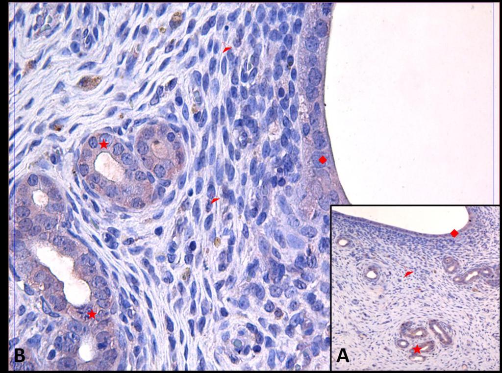 Fotoğraf 14A, B: Hipertermi uygulamasından bir saat önce NaCl+ Katalaz+ SOD uygulanan ve Hipertermi sonrası 6.