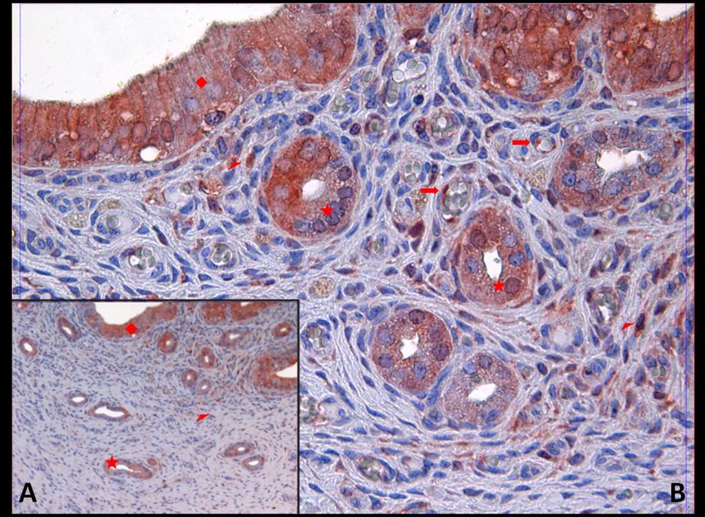 Fotoğraf 15A, B: Hipertermi uygulamasından bir saat önce NaCl+Katalaz uygulanan ve 24 saat sonra örneklerin alındığı gruba ait uterus dokusunda Kaspaz 9