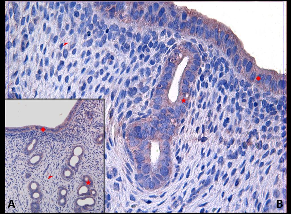 Fotoğraf 16A, B: Hipertermi uygulamasından bir saat önce NaCl+ Katalaz+ SOD uygulanan ve hipertermi sonrası 24.