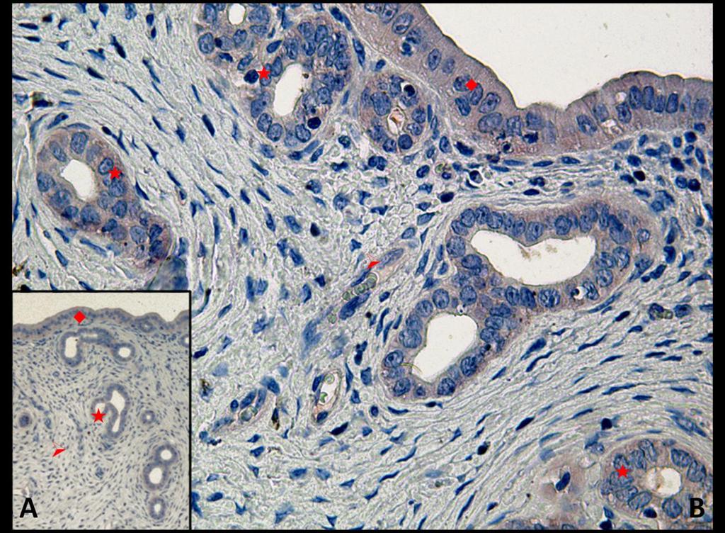 Fotoğraf 22A, B: Hipertermi uygulamasından bir saat önce NaCl+Katalaz uygulanan ve 6 saat sonra örneklerin alındığı gruba ait uterus dokusunda Kaspaz 3